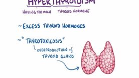 Hyperthyroidism