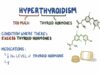 Hypothyroidism treatment medications
