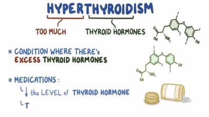 Hypothyroidism treatment medications