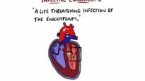 Infective Endocarditis (With Duke Criteria Pathophysiology)