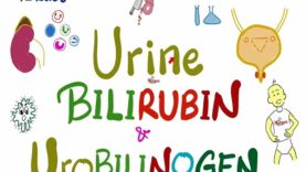 Jaundice Lab Tests – Urine Bilirubin Urobilinogen – How to diagnose jaundice (icterus)