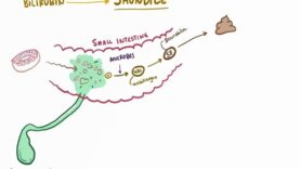Jaundice – causes, treatment pathology
