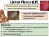 Lichen Planus (“Purple Skin Lesions”) – Causes, Signs Symptoms, Diagnosis, Treatment