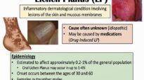 Lichen Planus (“Purple Skin Lesions”) – Causes, Signs Symptoms, Diagnosis, Treatment