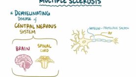 Multiple sclerosis – causes, symptoms, diagnosis, treatment, pathology