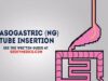 Nasogastric (NG) Tube Insertion – OSCE Guide – UKMLA – CPSA