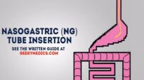 Nasogastric (NG) Tube Insertion – OSCE Guide – UKMLA – CPSA