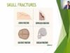 SKULL FRACTURE TYPES- HEAD INJURIES