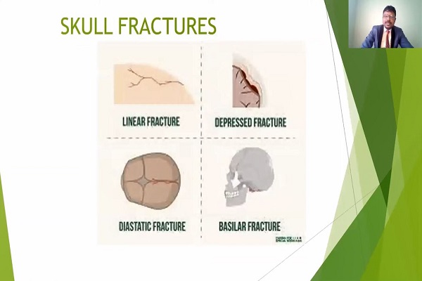 SKULL FRACTURE TYPES- HEAD INJURIES