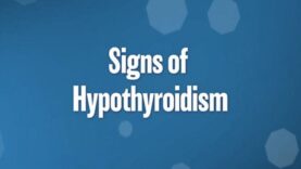 Signs of Hypothyroidism – UCLA Endocrine Center