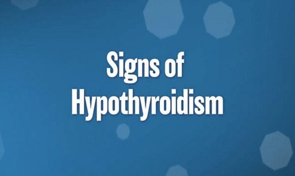 Signs of Hypothyroidism – UCLA Endocrine Center