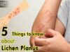 Top 5 Things to Know about Lichen Planus