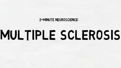 2 Minute Neuroscience Multiple Sclerosis