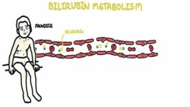 Approach to Jaundice types and causes of hyperbilirubin
