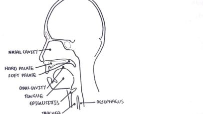 Clinical Anatomy NasalCavity and Sinuses