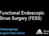 Functional Endoscopic Sinus Surgery (FESS) for sinusitis