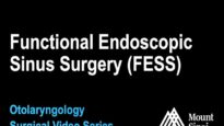 Functional Endoscopic Sinus Surgery (FESS) for sinusitis