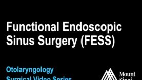 Functional Endoscopic Sinus Surgery (FESS) for sinusitis