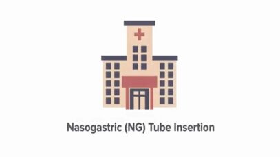 How To Insert a Nasogastric NG Tube Measurement Placeme