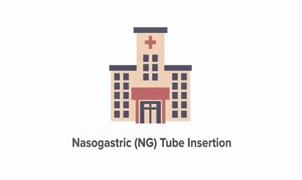 How To Insert a Nasogastric NG Tube Measurement Placeme
