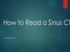 How to read a Sinus CT