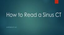 How to read a Sinus CT