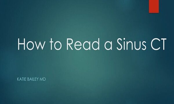 How to read a Sinus CT