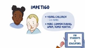 Impetigo- Clinical Nursing Care