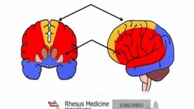 Middle Cerebral Artery Stroke Syndromes MCA Stroke Synd
