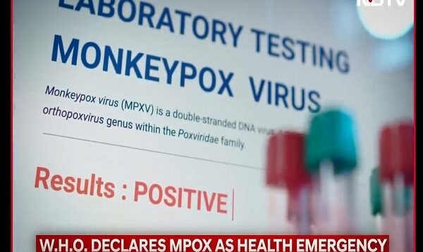 Monkeypox Virus 5 Things You Should Know About MonkeyPo