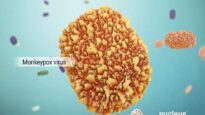 Mpox (Monkeypox)