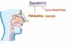 Sinusitis causes symptoms diagnosis treatment pathology