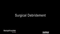 Surgical Debridement Of A Wound Best Multispeciality