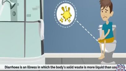 What is Diarrhea Causes Signs and Symptoms Diagnosis