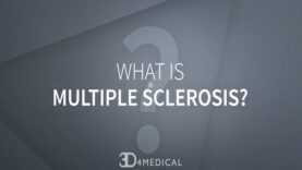What is Multiple Sclerosis