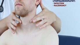 Abdominal Examination – OSCE Guide (Latest) _ UKMLA _ CPSA