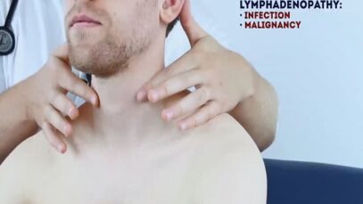 Abdominal Examination – OSCE Guide (Latest) _ UKMLA _ CPSA