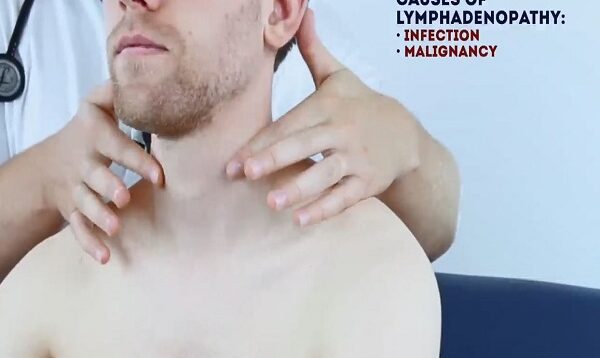 Abdominal Examination – OSCE Guide (Latest) _ UKMLA _ CPSA