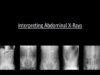 Abdominal X-Rays Made Easy
