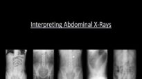 Abdominal X-Rays Made Easy
