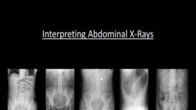 Abdominal X-Rays Made Easy