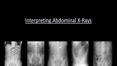 Abdominal X-Rays Made Easy