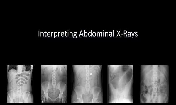 Abdominal X-Rays Made Easy
