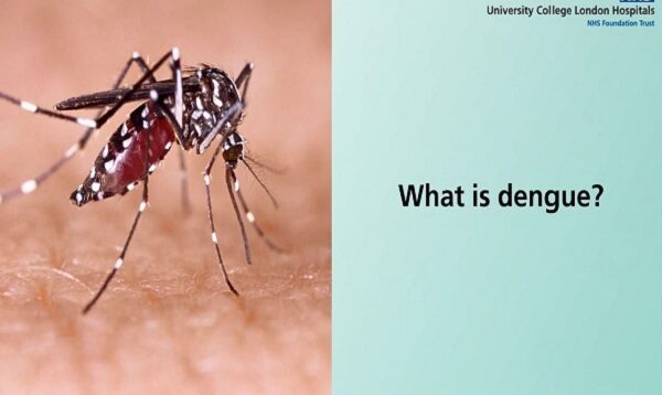 Dengue Fever – Understanding the symptoms, prevention, and effective treatment methods