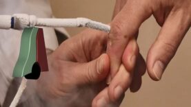 Finger Wart Cryotherapy Probe