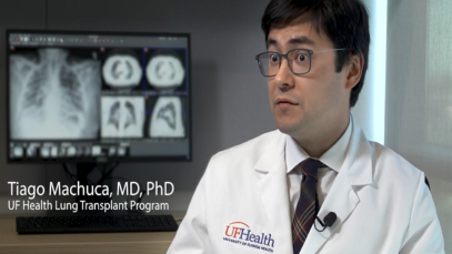 Lung transplant success