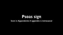 Psoas Sign