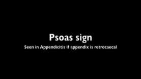 Psoas Sign