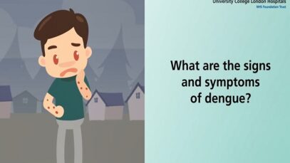 What are the signs and symptoms of dengue fever.