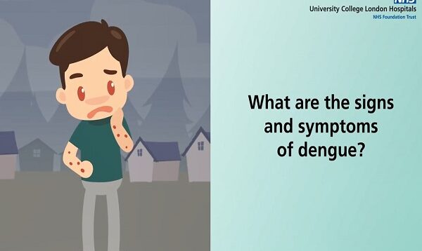 What are the signs and symptoms of dengue fever.